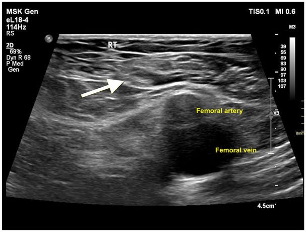Hernias parte II.jpg